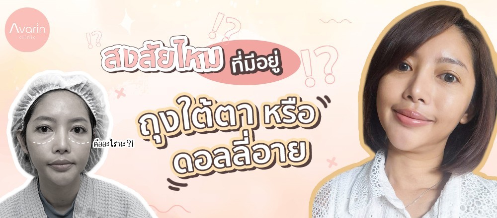 ถุงใต้ตา1