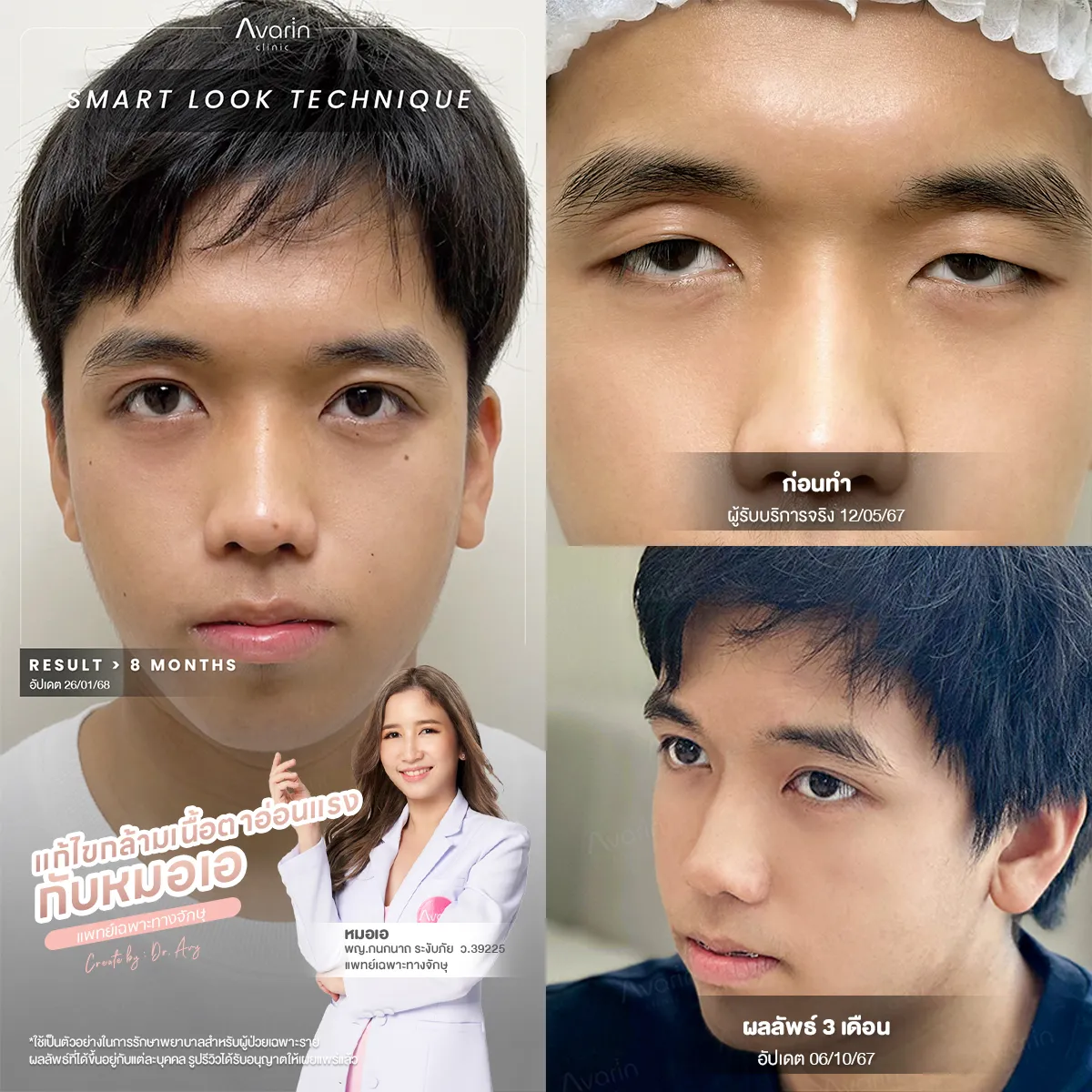รวมน้องเอส-22-08-69