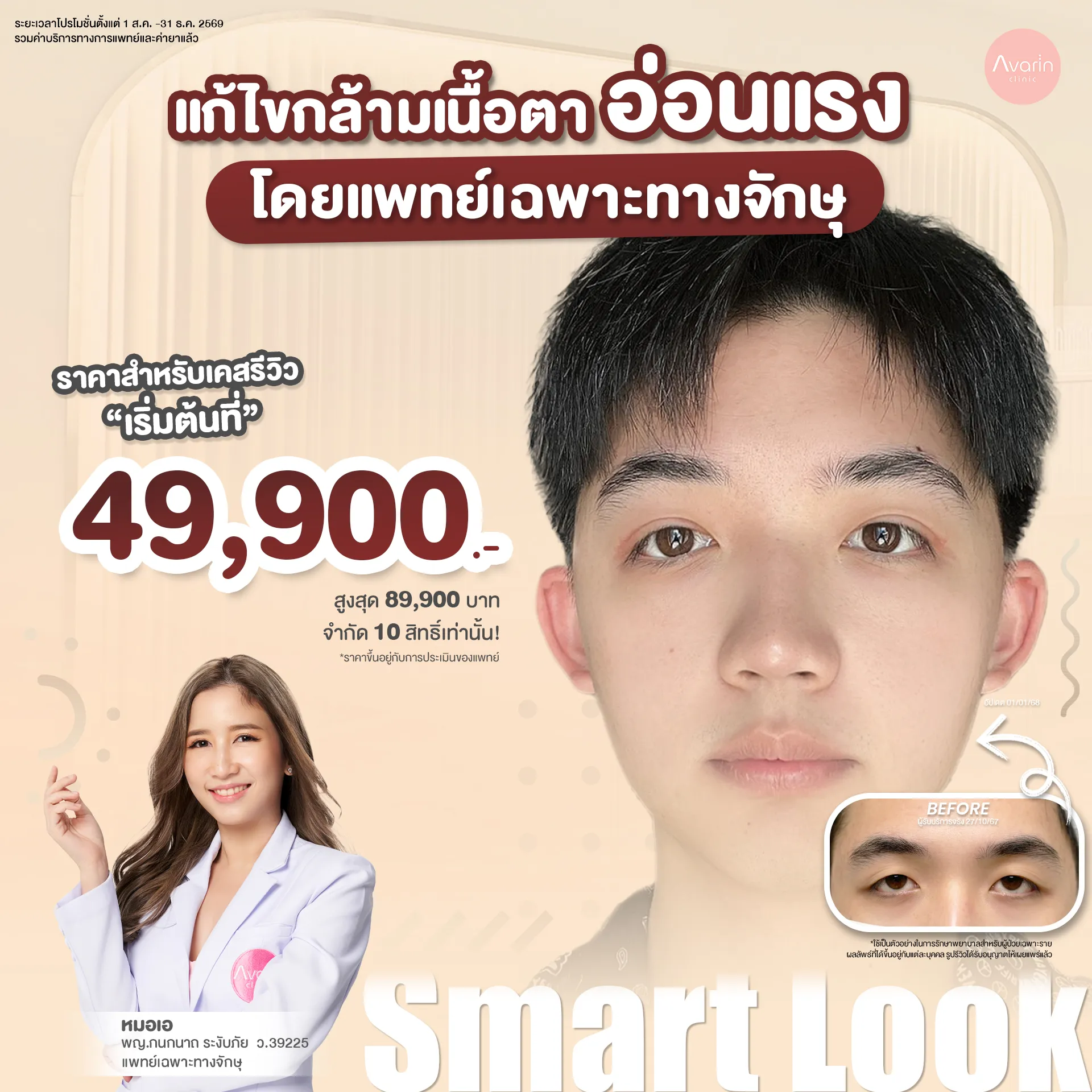 ลีโอ-21-008-69