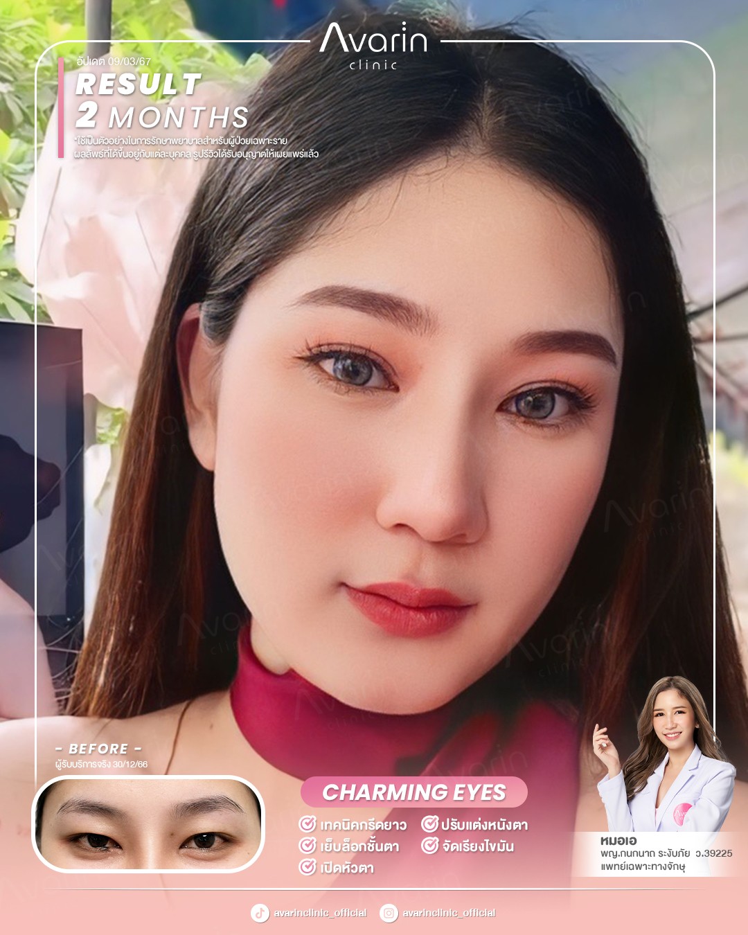 หน้าเต็ม-นัท-2เดือน