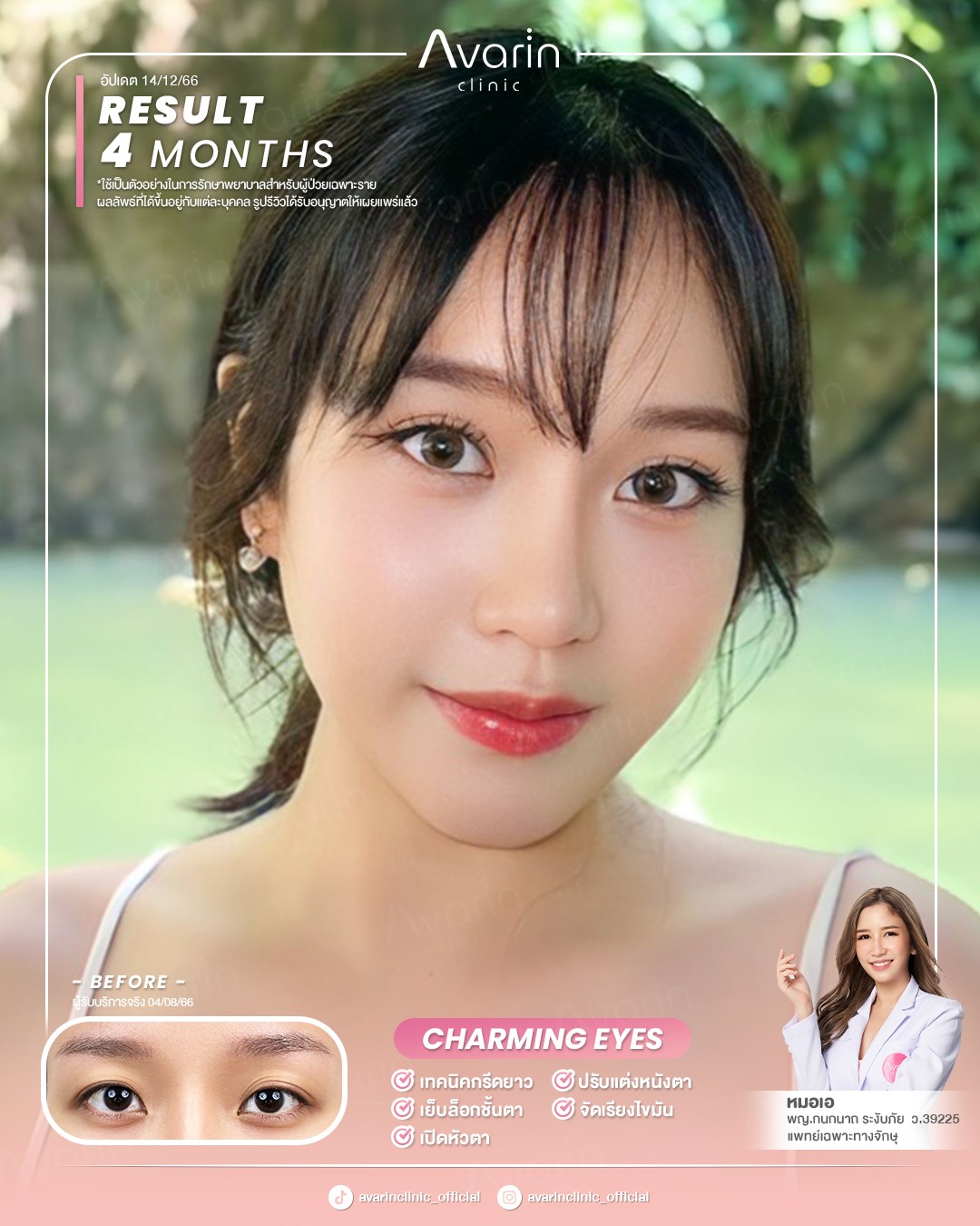 หน้าเต็ม-หลิน-4เดือน