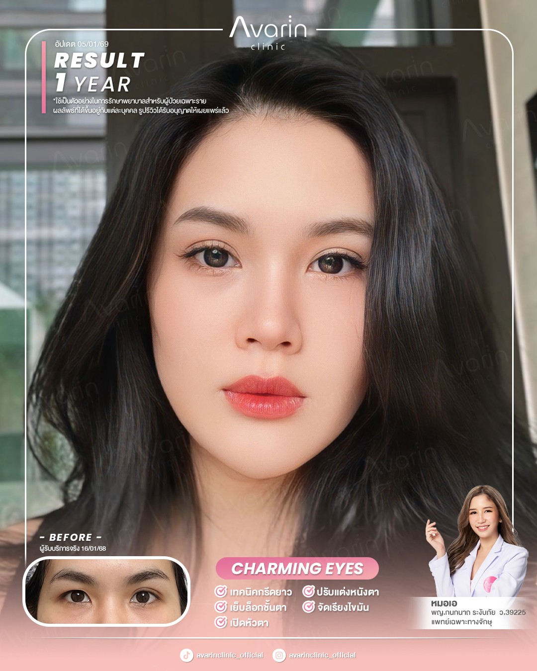 หน้าเต็มใหม่-นัท-1ปี