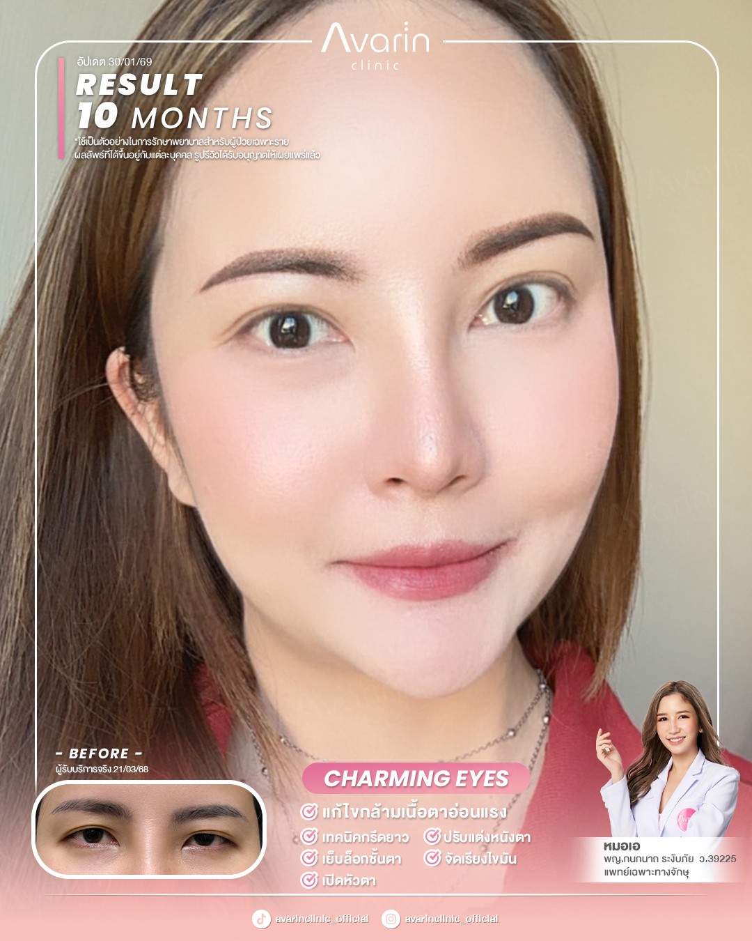 หน้าเต็มใหม่-อ้อม-10เดือน