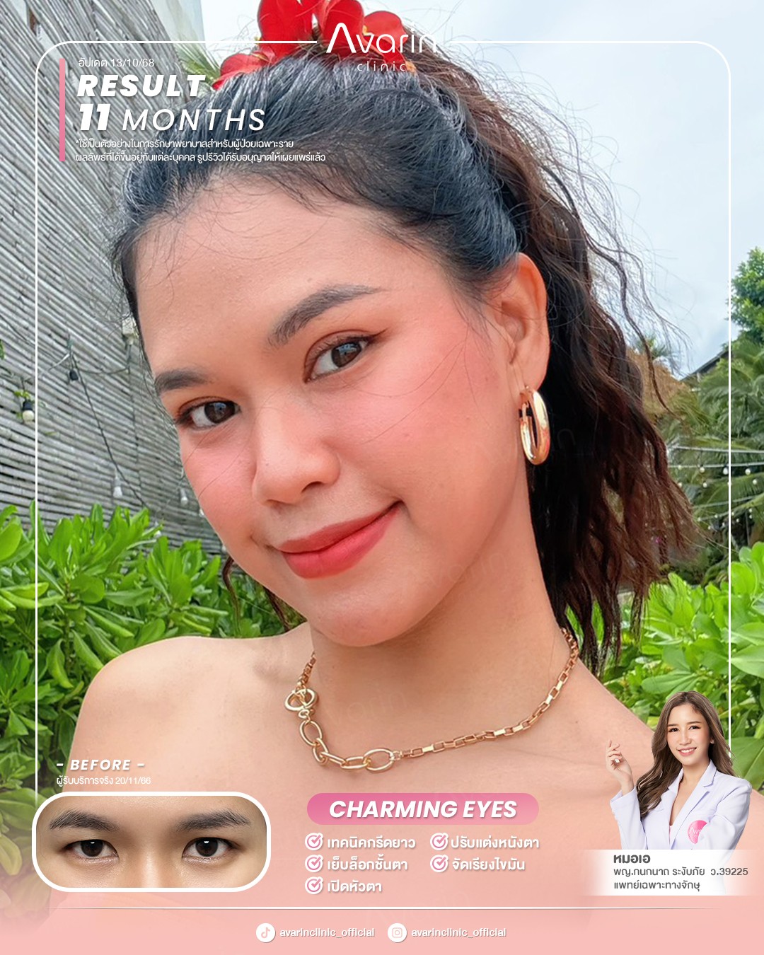 หน้าเต็มใหม่-เจน-10เดือน