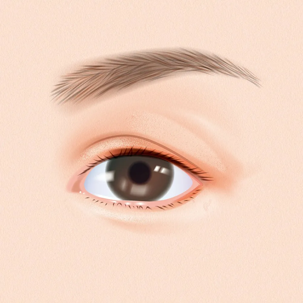 แก้ตาที่เคยทำมา