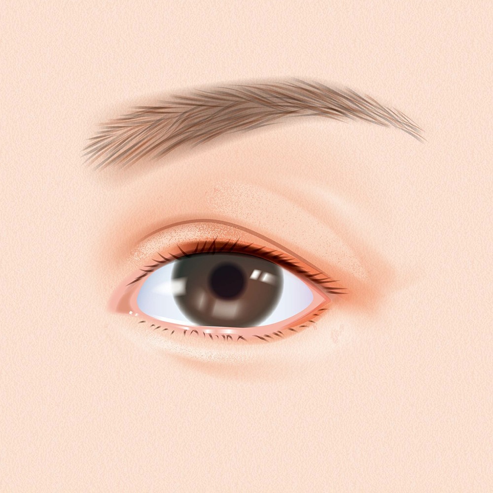แก้ตาที่เคยทำมา
