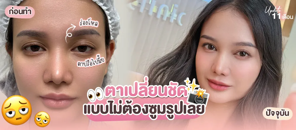 ปกคะนิ้ง0