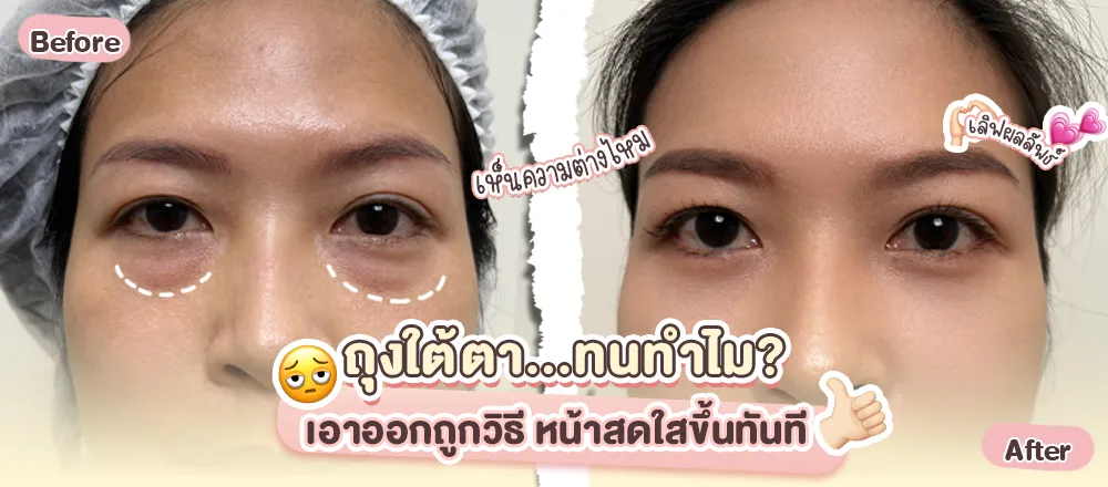 ปกคุณเง็ก