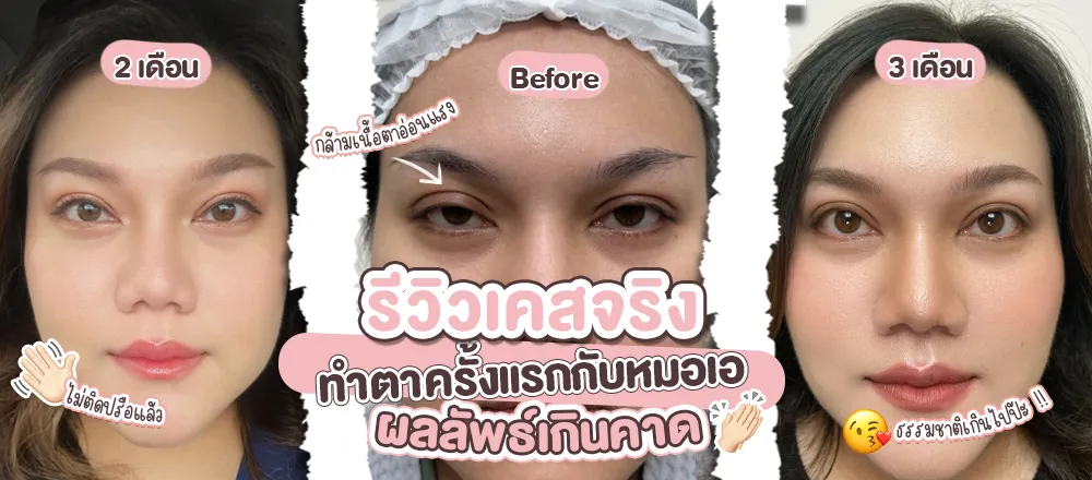 ปกคุณแบงค์