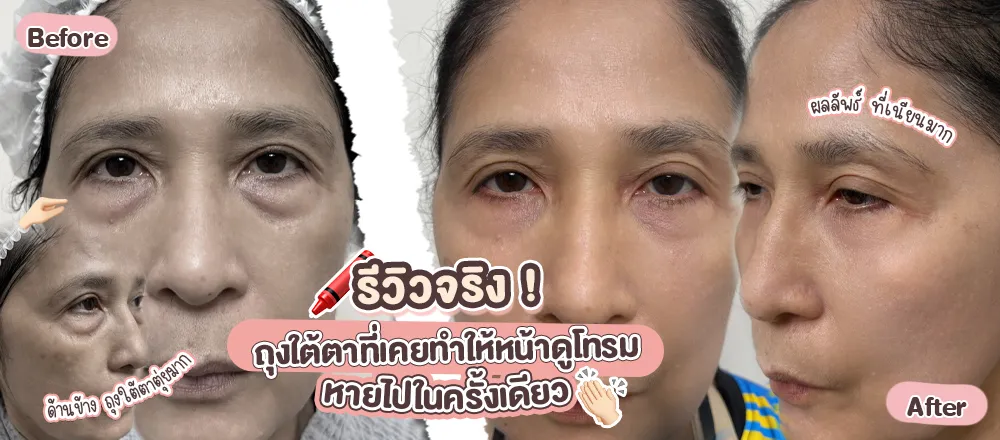 ปกป้านก