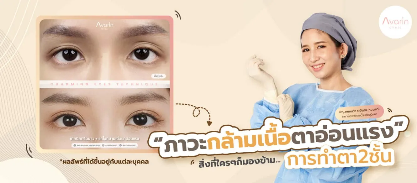 ฉันมีกล้ามเนื้อตาอ่อนแรงมั้ยนะ