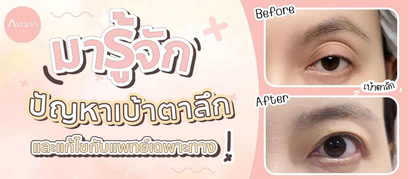 ตาโหล