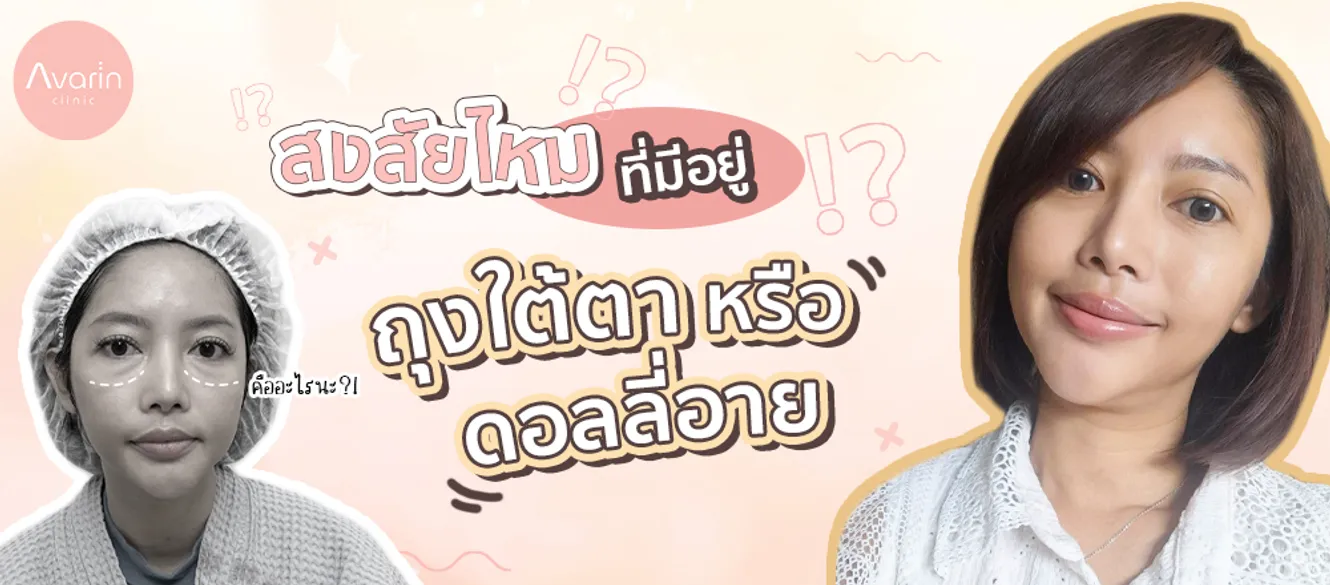 ถุงใต้ตาหรือดอลลี่อาย