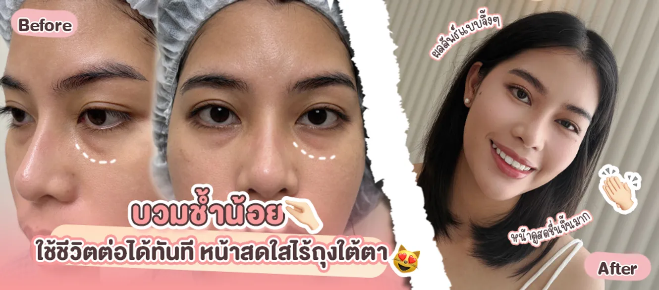 ปกคุณเบียร์