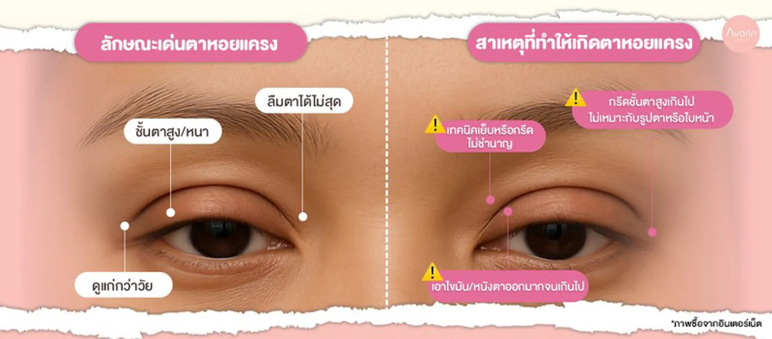 download-(1)