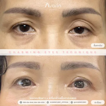 B&A-กุ้ง-8เดือน