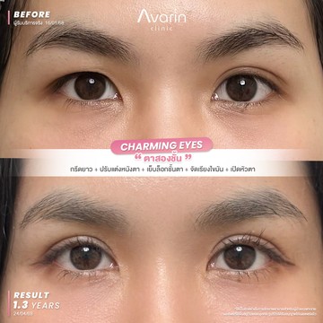 B&A-นัท-1