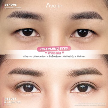 B&A-พีช-2เดือน