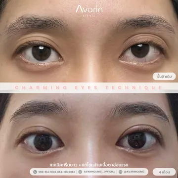 B&A-มิลค์-4เดือน