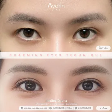 B&A-หยก-4เดือน