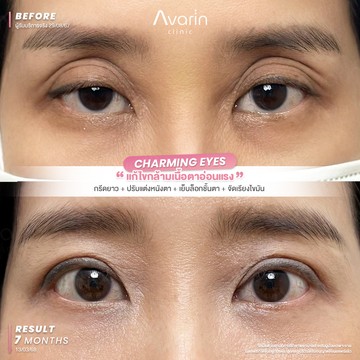 B&A-เกด-7เดือน