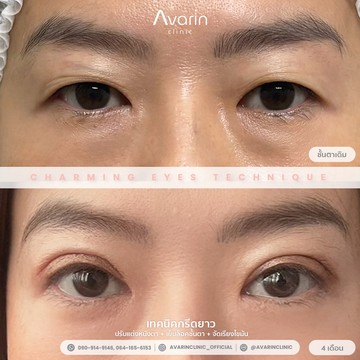 B&A-เง็ก-4เดือน
