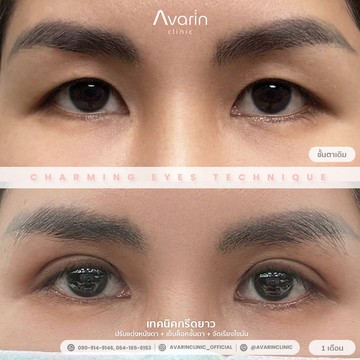 B&A-เมย์-1เดือน