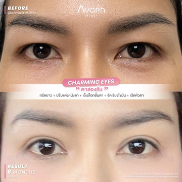 B&A-เอ้-6เดือน