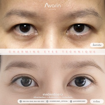 B&A-แอปเปิ้ล-8เดือน