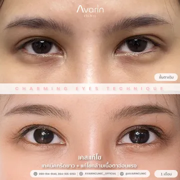 B&Aจ๊อยซ์
