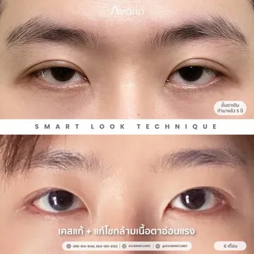 LINEALBUMแก้กล้าม-ผู้ชาย2504235