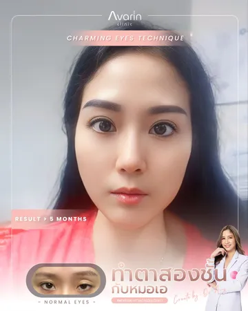 LINEALBUMแก้กล้ามผญ25042548