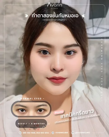 กรีดยาว