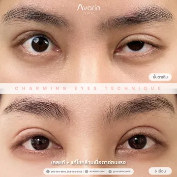 คุณกวาง6เดือน-1-1024x102438891617482