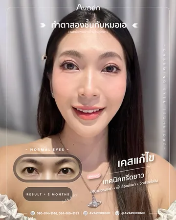 คุณแป้ง1
