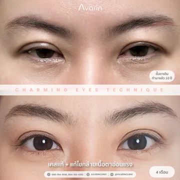 คุณแอม4เดือน