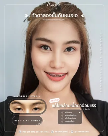 ตกไม่เท่ากัน