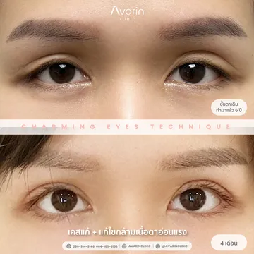 ทราย(4เดือน)