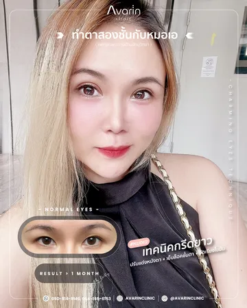 ทิพย์(1เดือน)