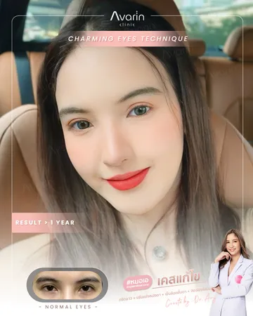 น้ำตาล-แก้ตัด-1ปี