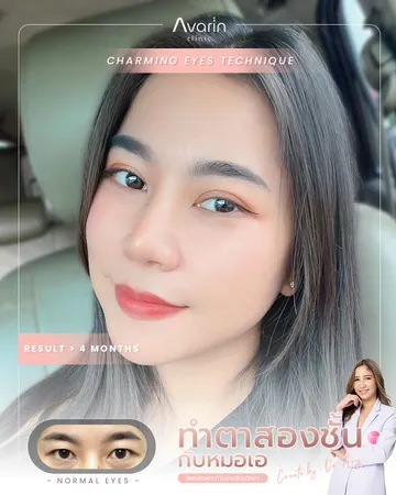 ปู-1