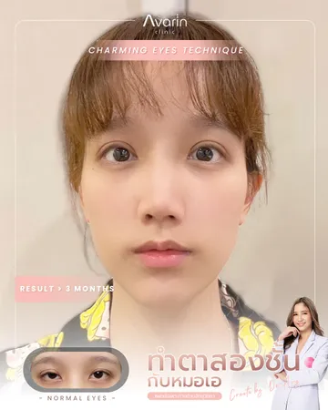 มีน