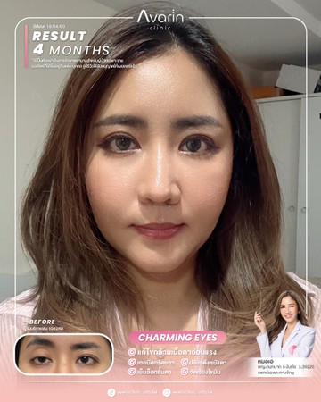 หน้าเต็ม-จูน-4เดือน