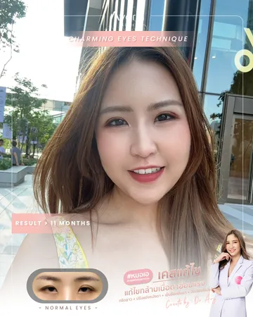 หน้าเต็ม-ดาว-11เดือน
