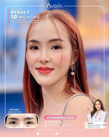 หน้าเต็ม-น้ำ-10-เดือน