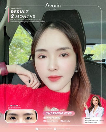 หน้าเต็ม-น้ำ-2เดือน