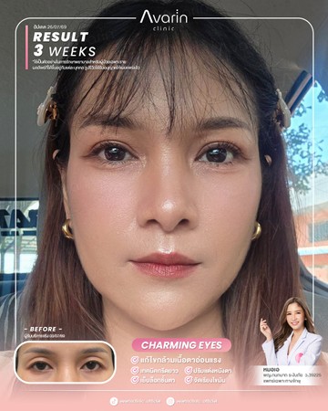 หน้าเต็ม-น้ำ-3weeks