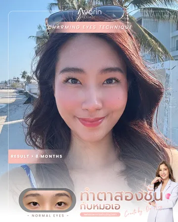 หน้าเต็ม-ปริม-8เดือน