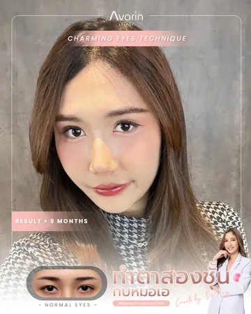 หน้าเต็ม-ปริม