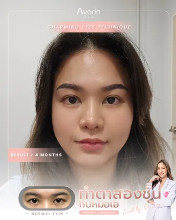 หน้าเต็ม-ปุ๋ย